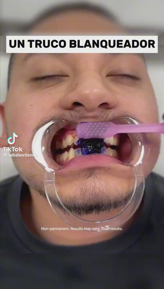 Lumea 💜 Corrige el tono amarillo de tus dientes en minutos